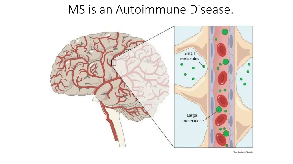 ms is an autoimmune disease