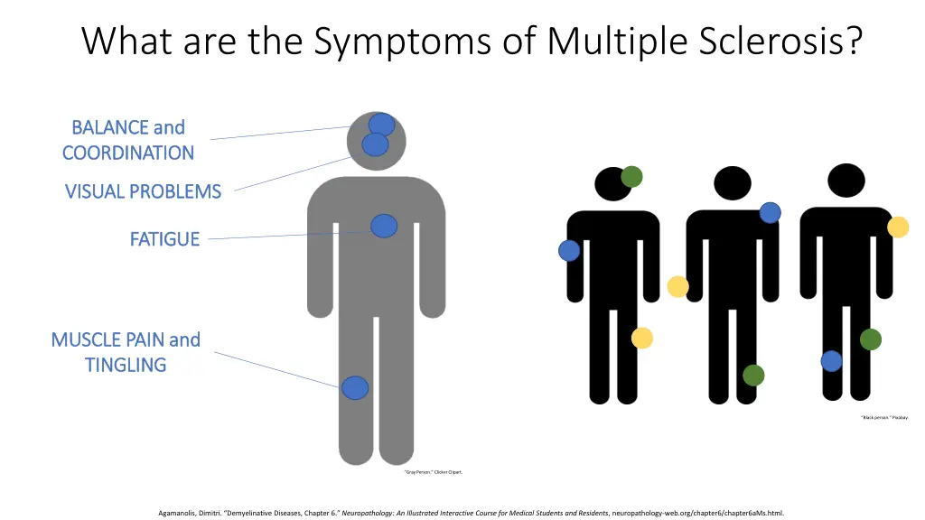 what are the symptoms of multiple sclerosis