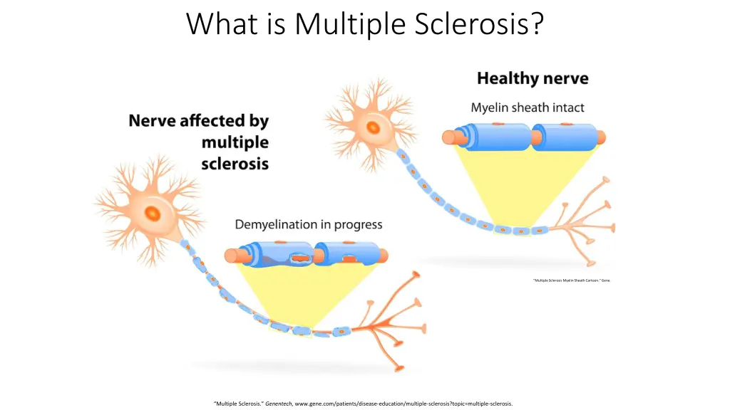 what is multiple sclerosis