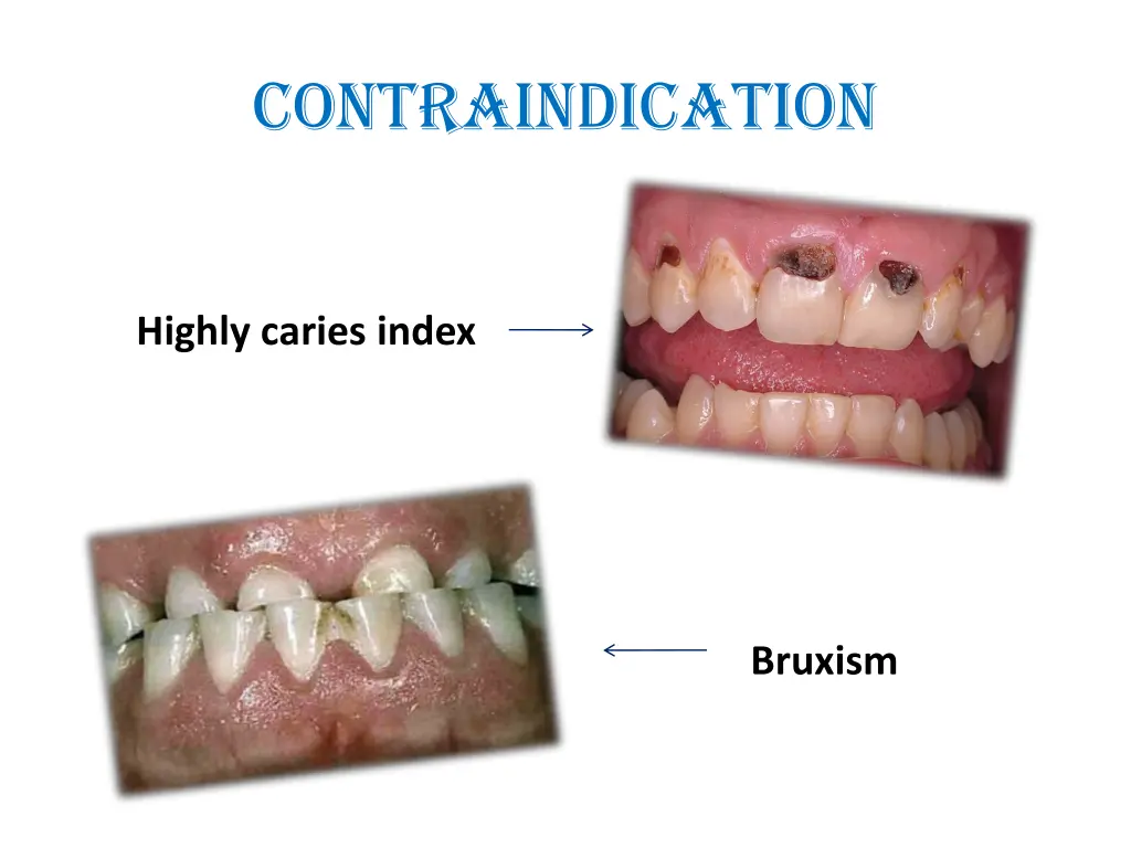 contraindication