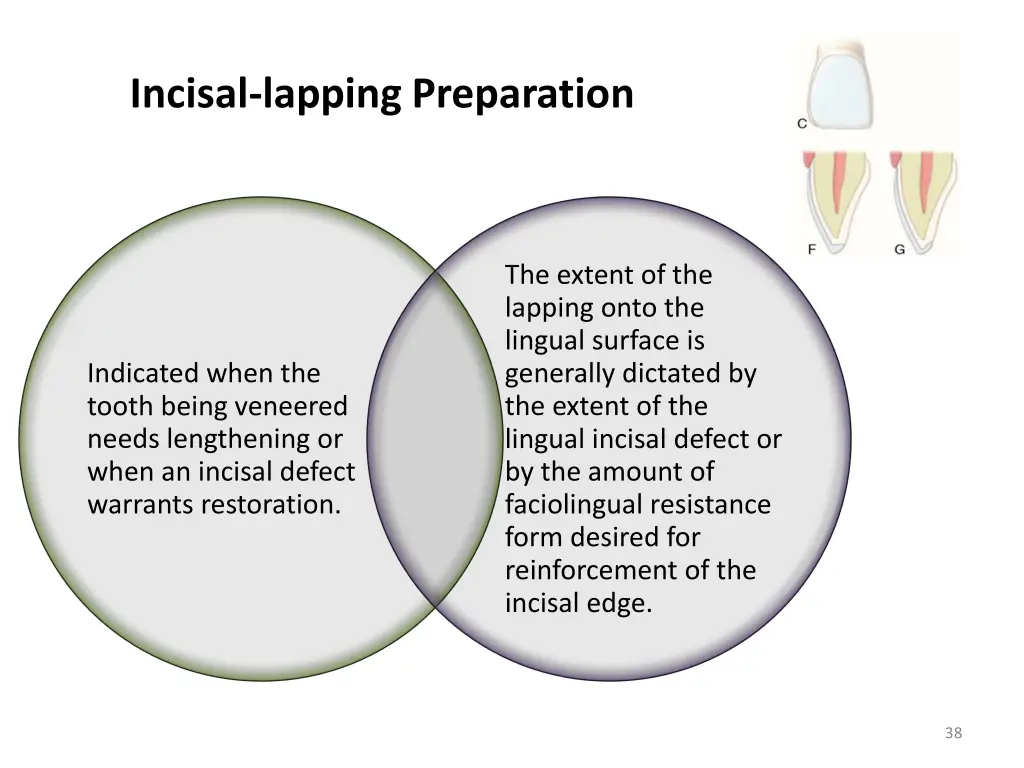 incisal lapping preparation