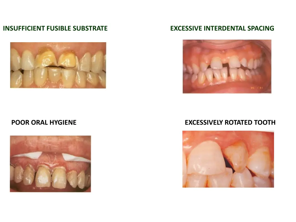 insufficient fusible substrate excessive