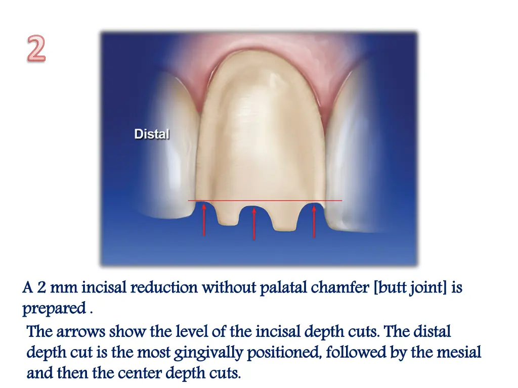 slide33