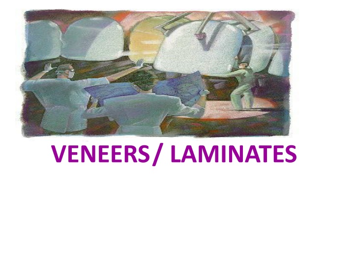 veneers laminates