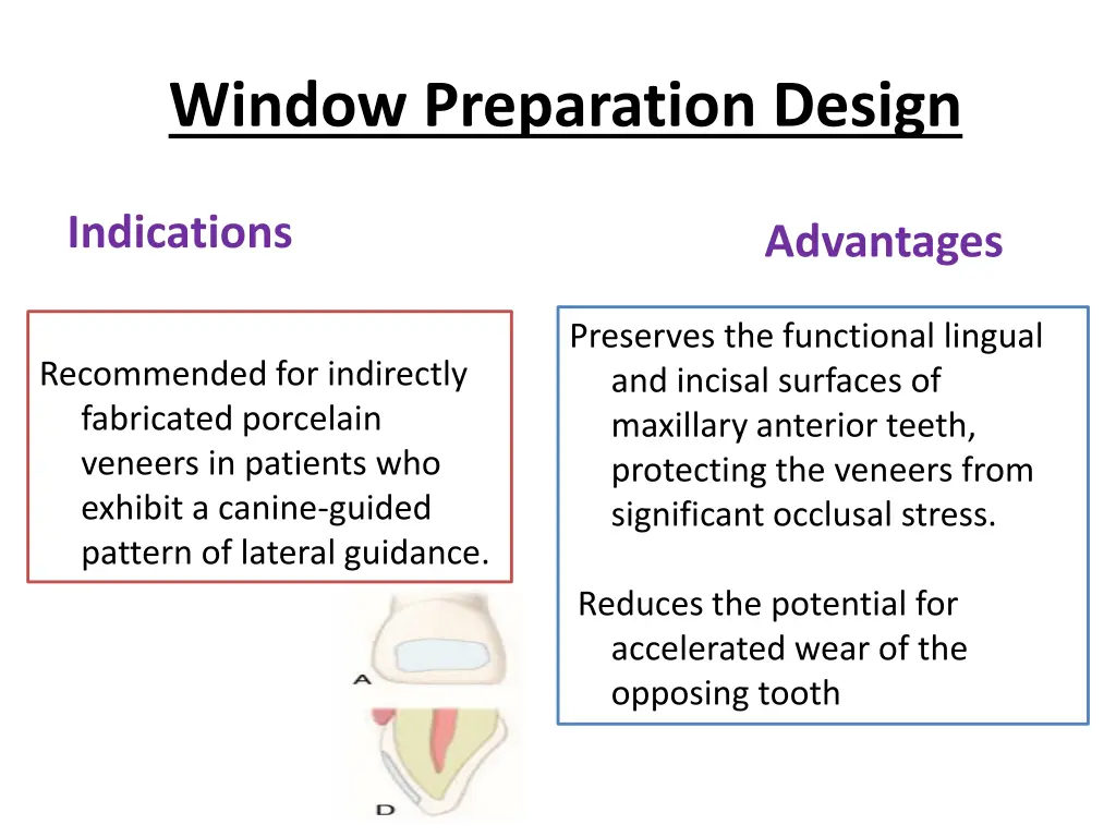 window preparation design