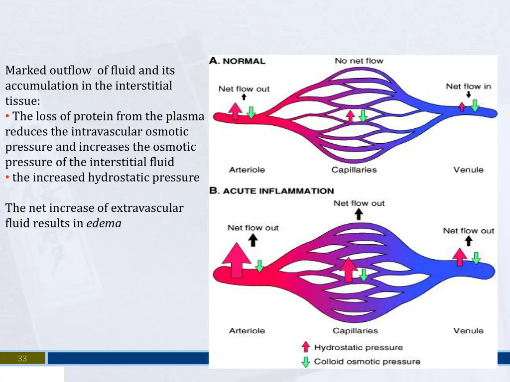 marked outflow of fluid and its accumulation