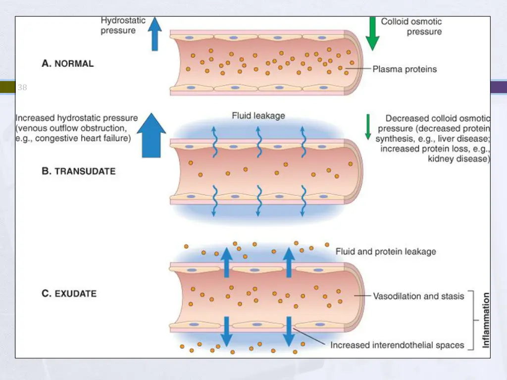 slide38