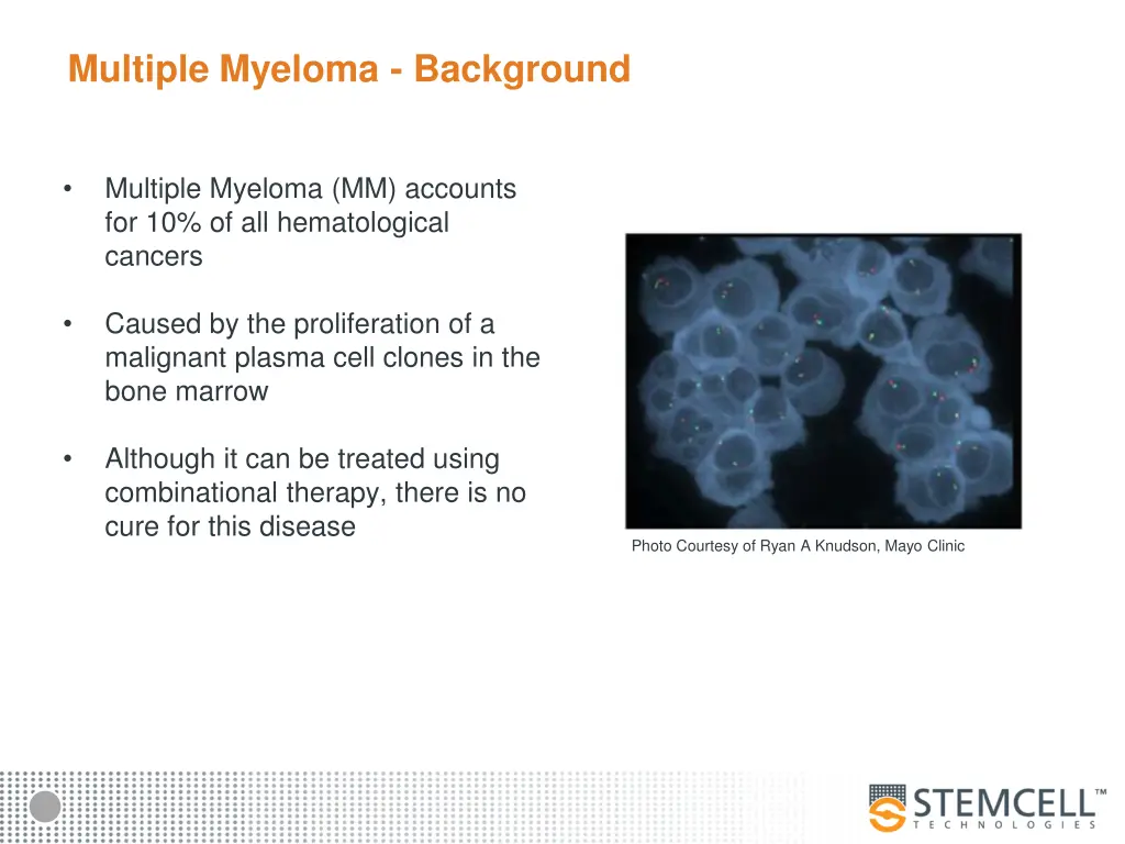 multiple myeloma background