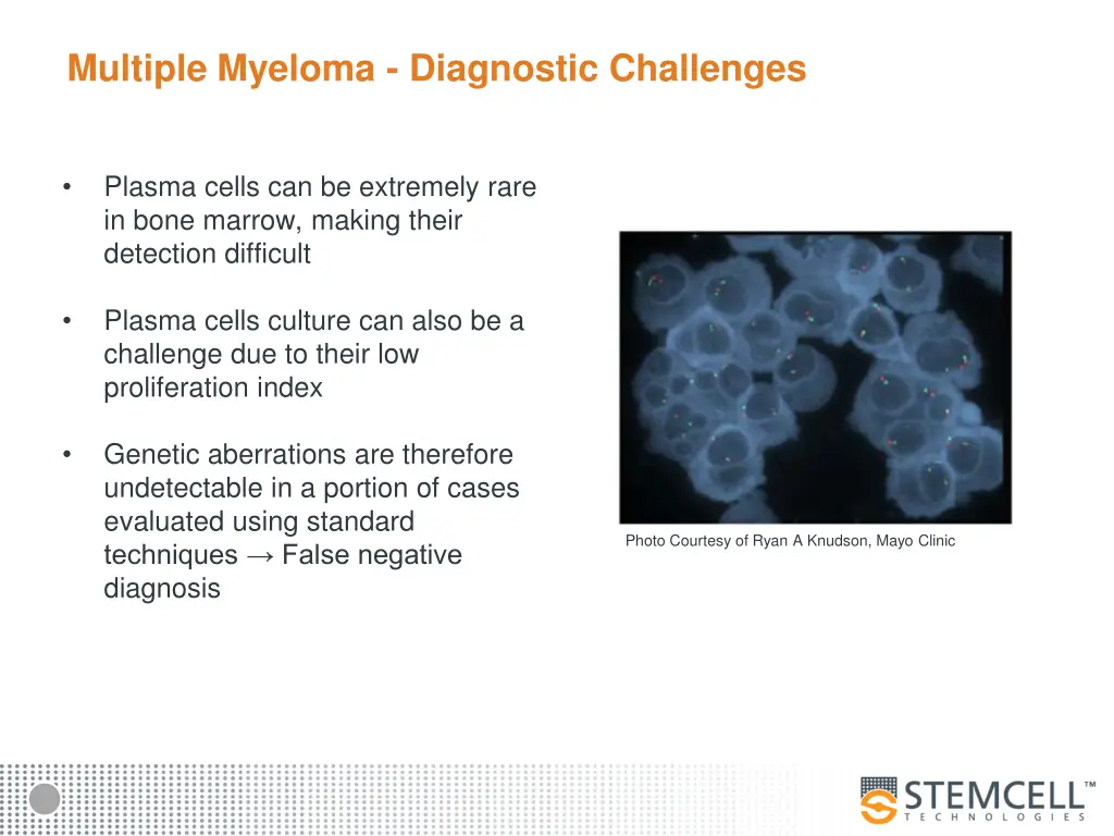 multiple myeloma diagnostic challenges