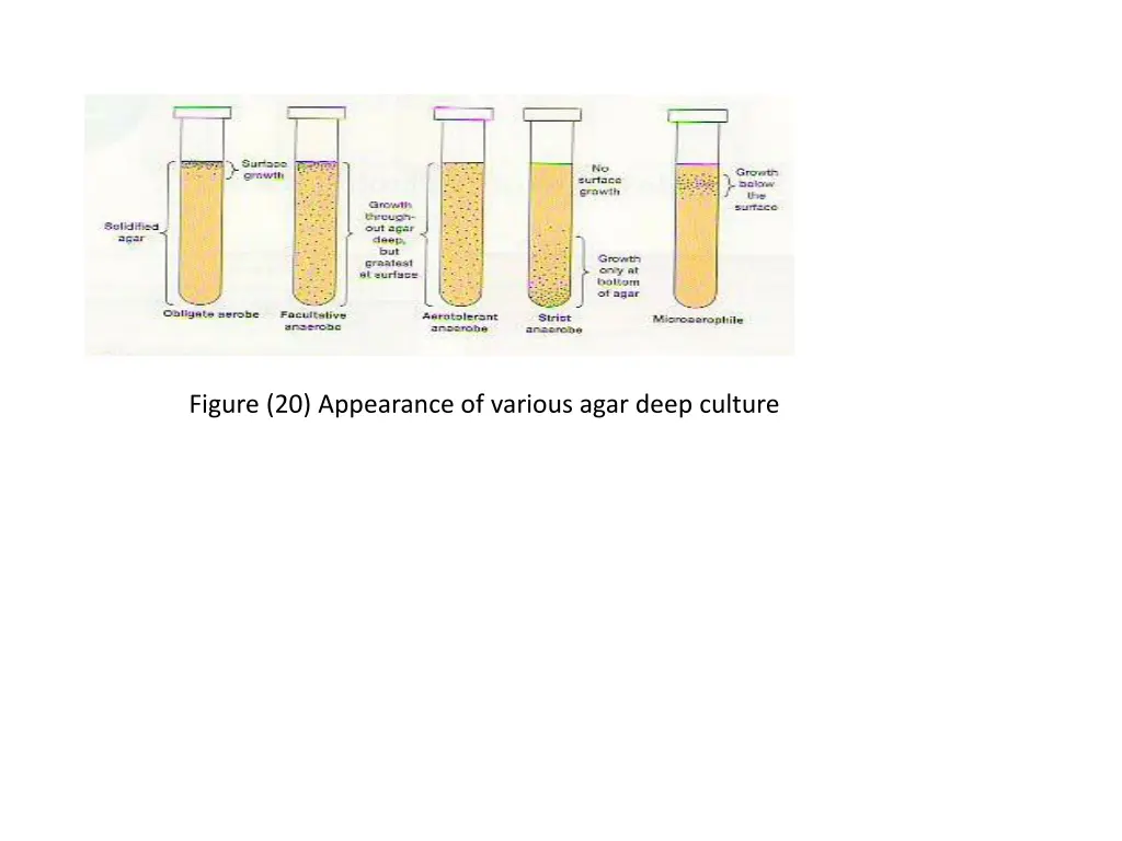 figure 20 appearance of various agar deep culture