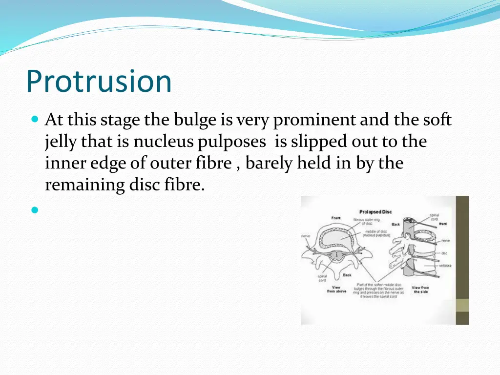 protrusion