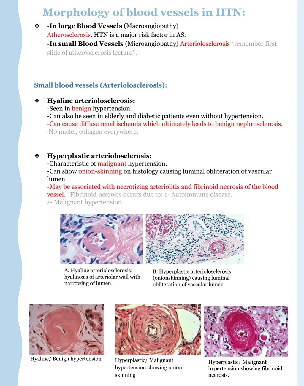 morphology of blood vessels in htn