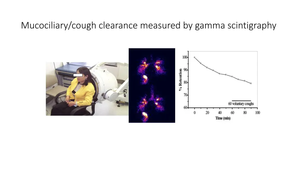 mucociliary cough clearance measured by gamma