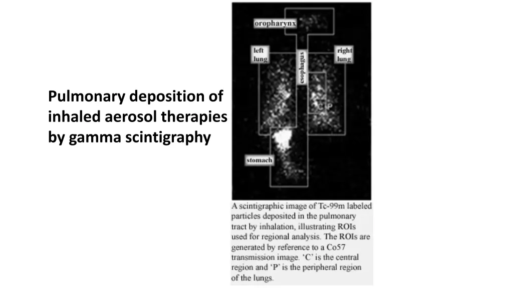 pulmonary deposition of inhaled aerosol therapies