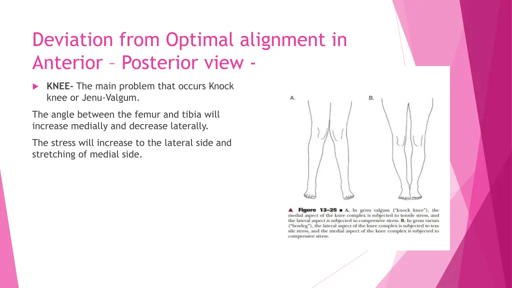 deviation from optimal alignment in anterior