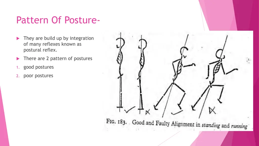 pattern of posture