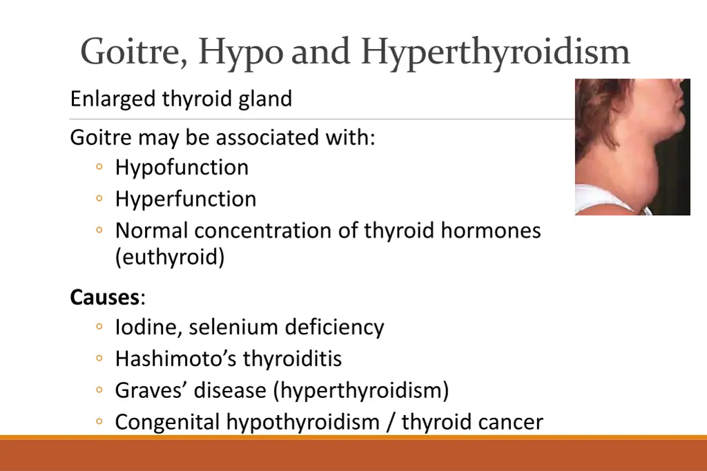 goitre hypo and hyperthyroidism