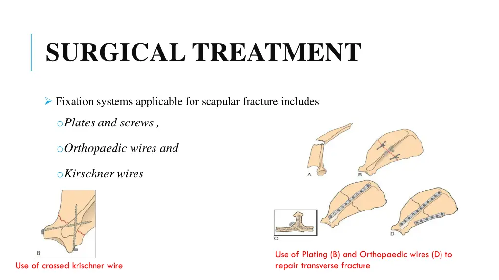 surgical treatment