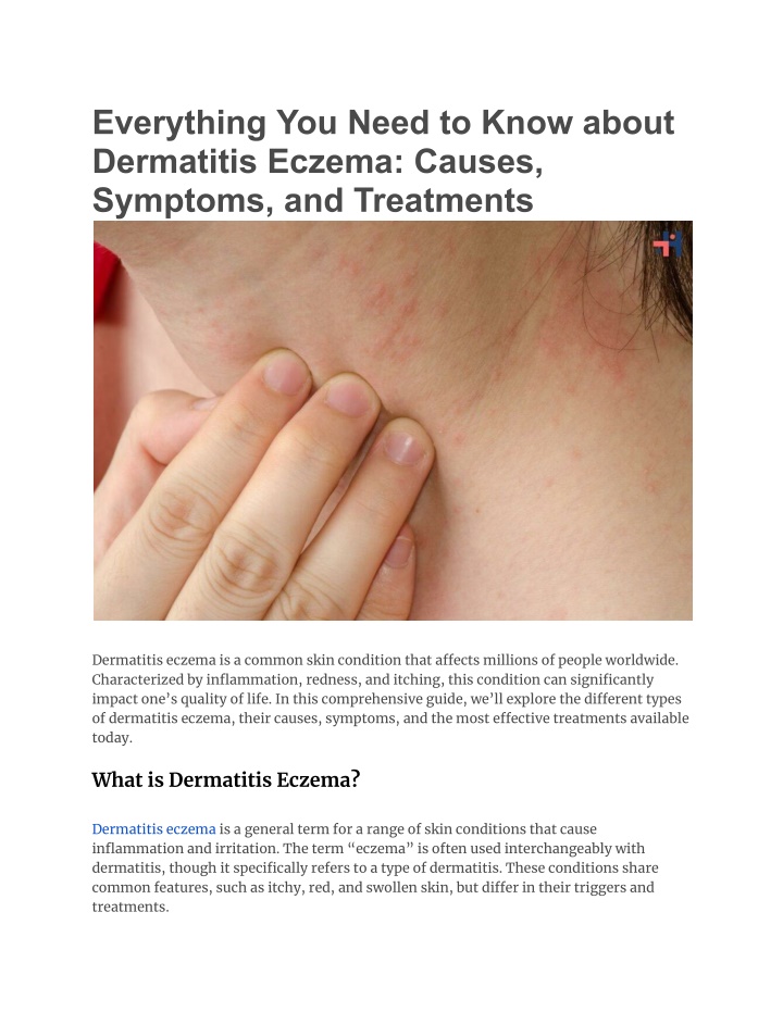 everything you need to know about dermatitis