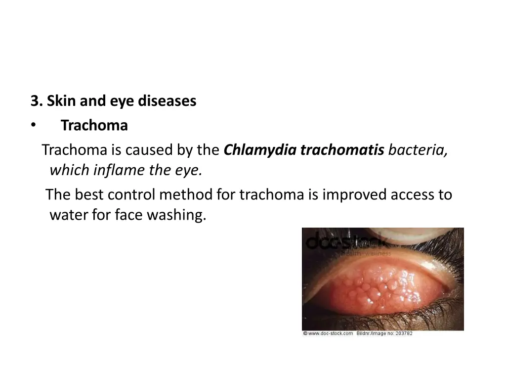 3 skin and eye diseases trachoma trachoma