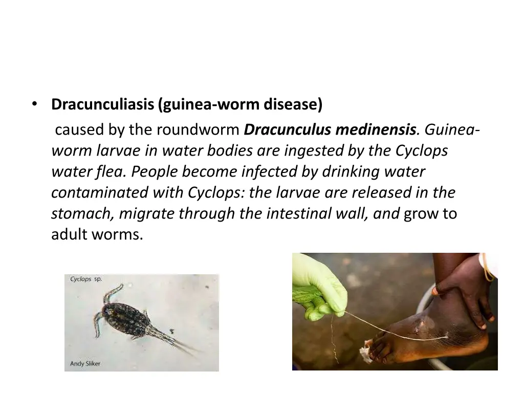 dracunculiasis guinea worm disease caused