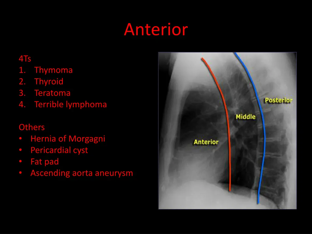 anterior