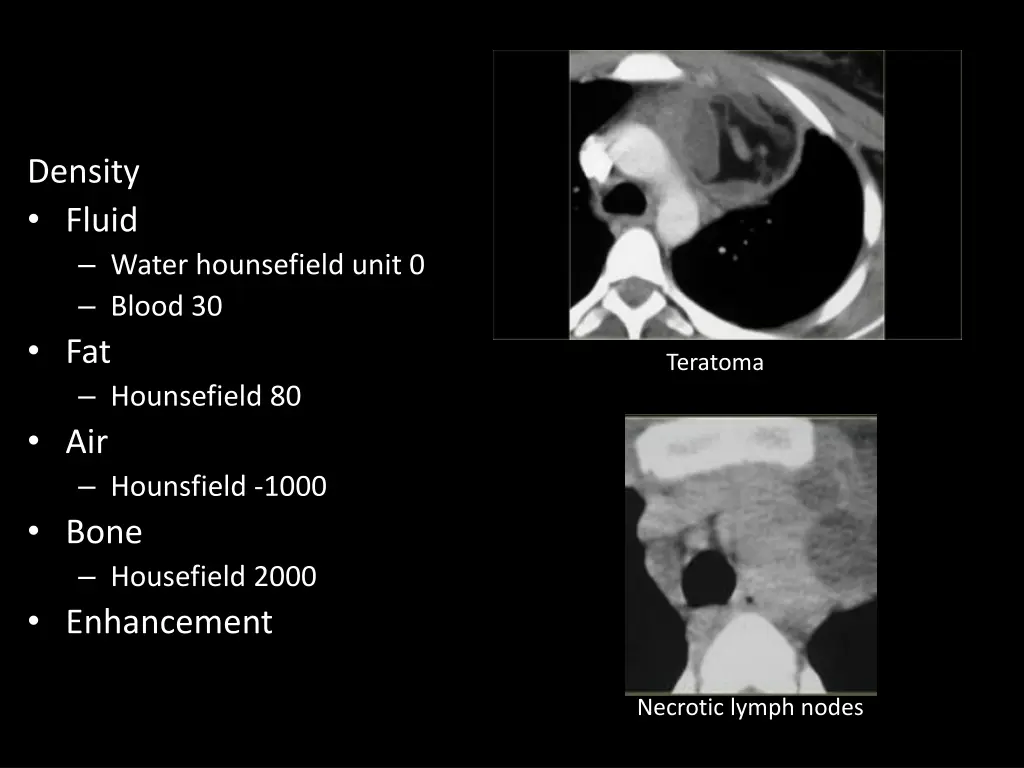 density fluid water hounsefield unit 0 blood