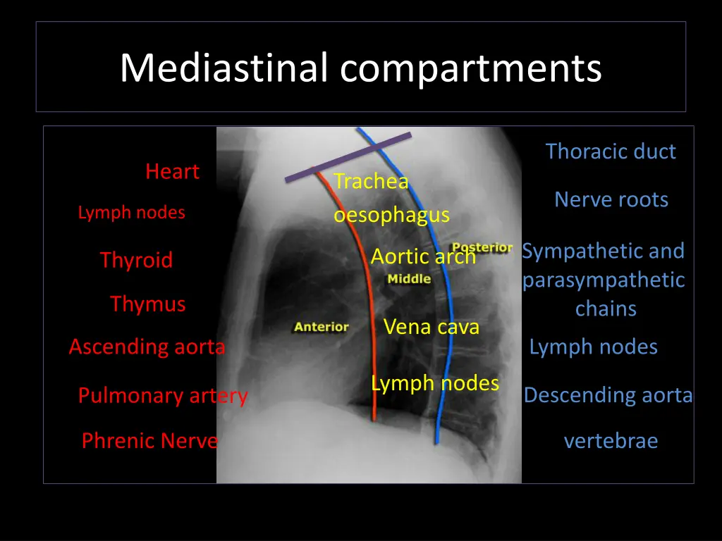 mediastinal compartments