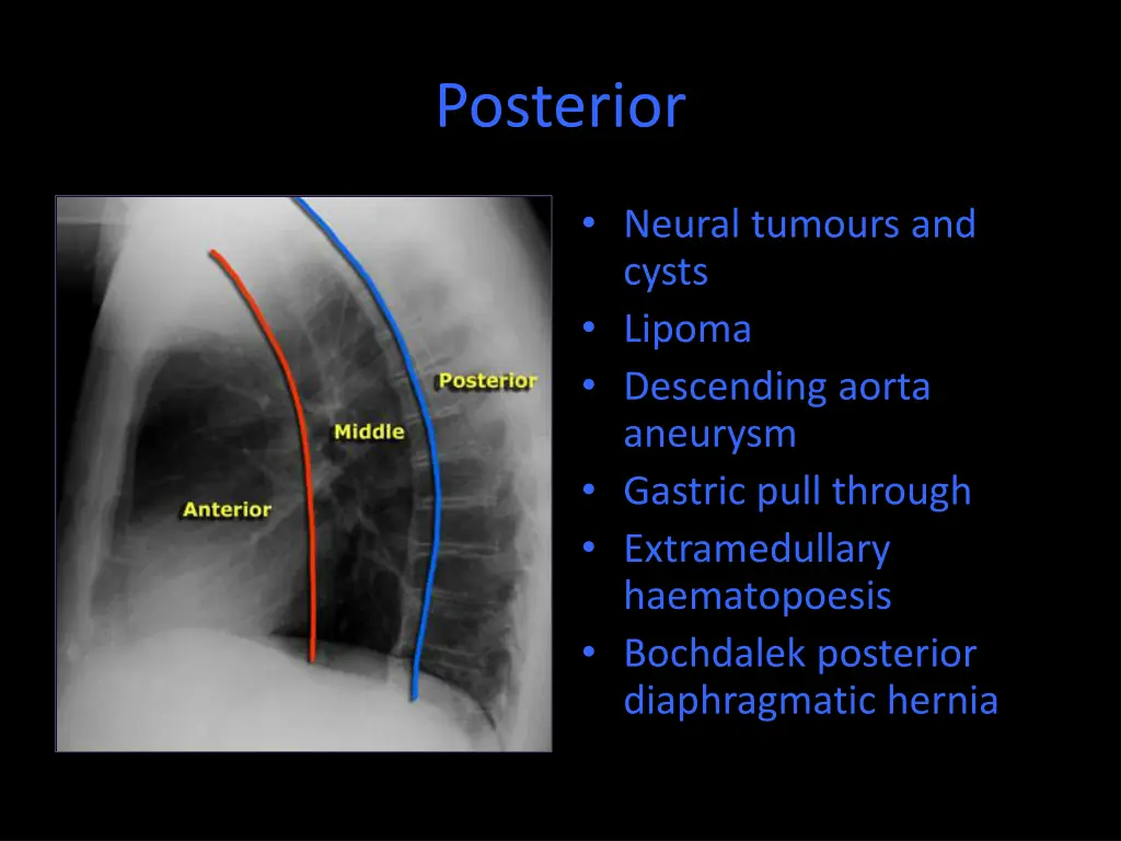 posterior