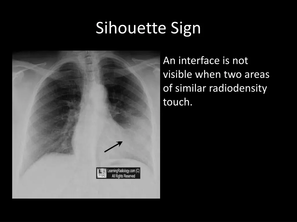 sihouette sign