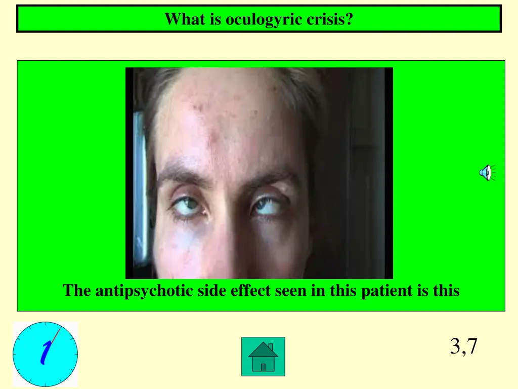 what is oculogyric crisis