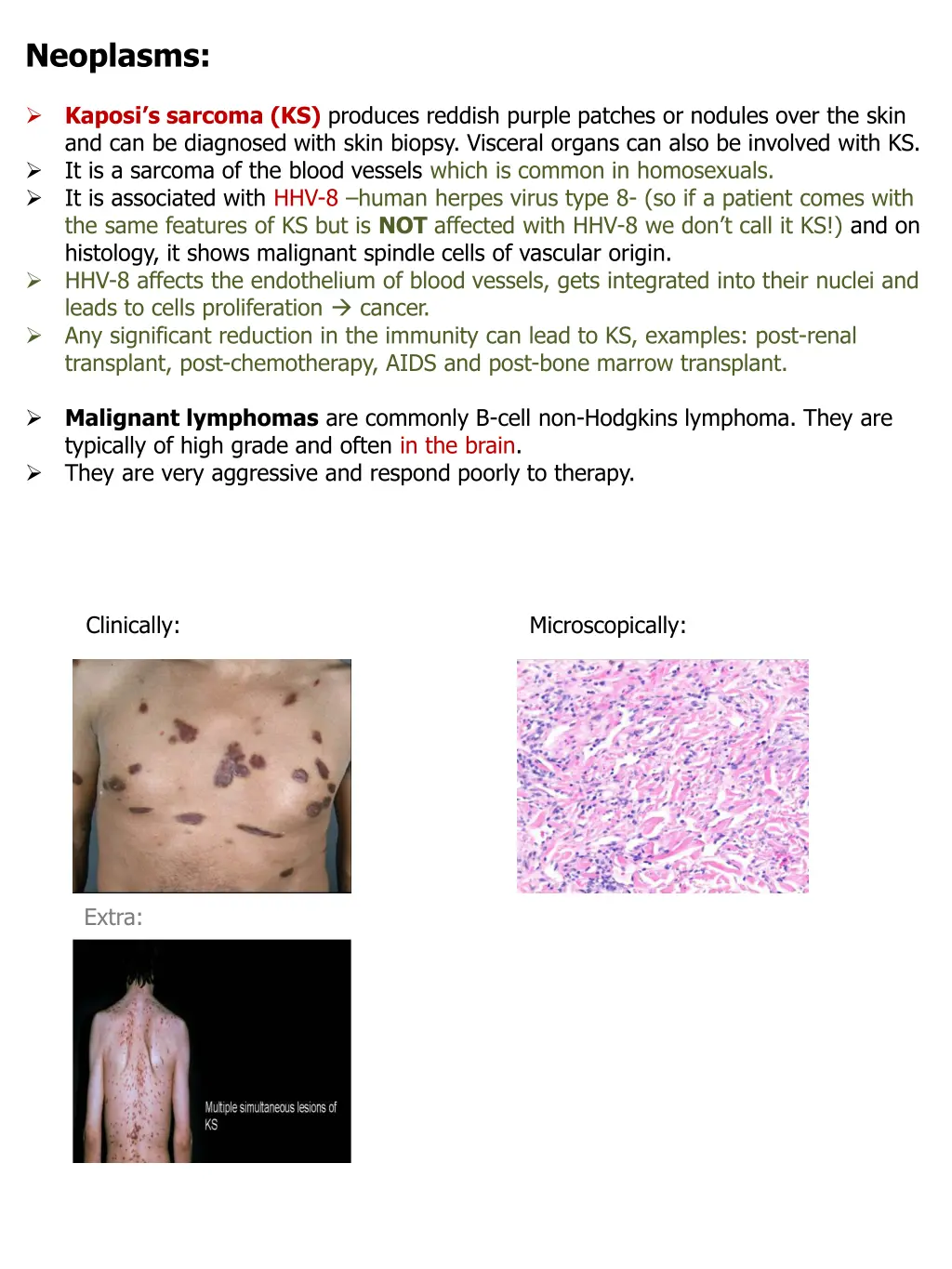 neoplasms