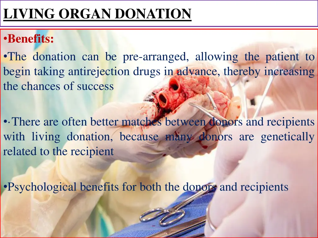 living organ donation