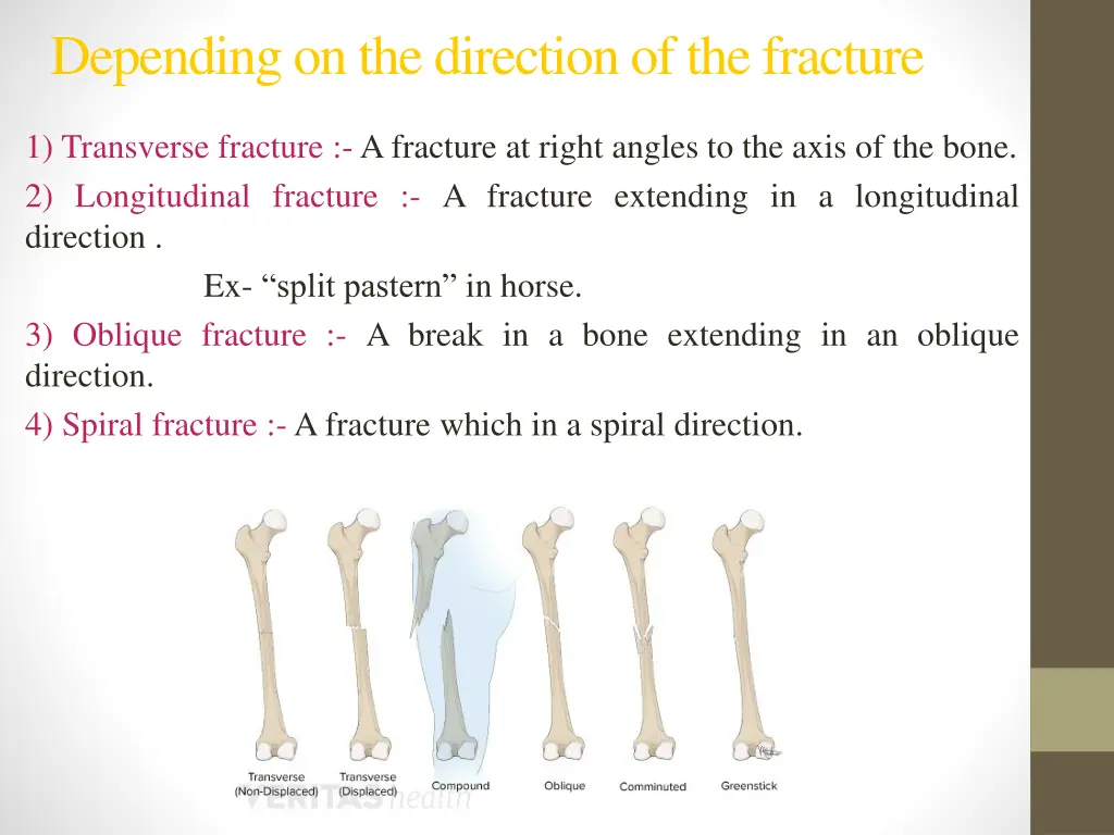 depending on the direction of the fracture