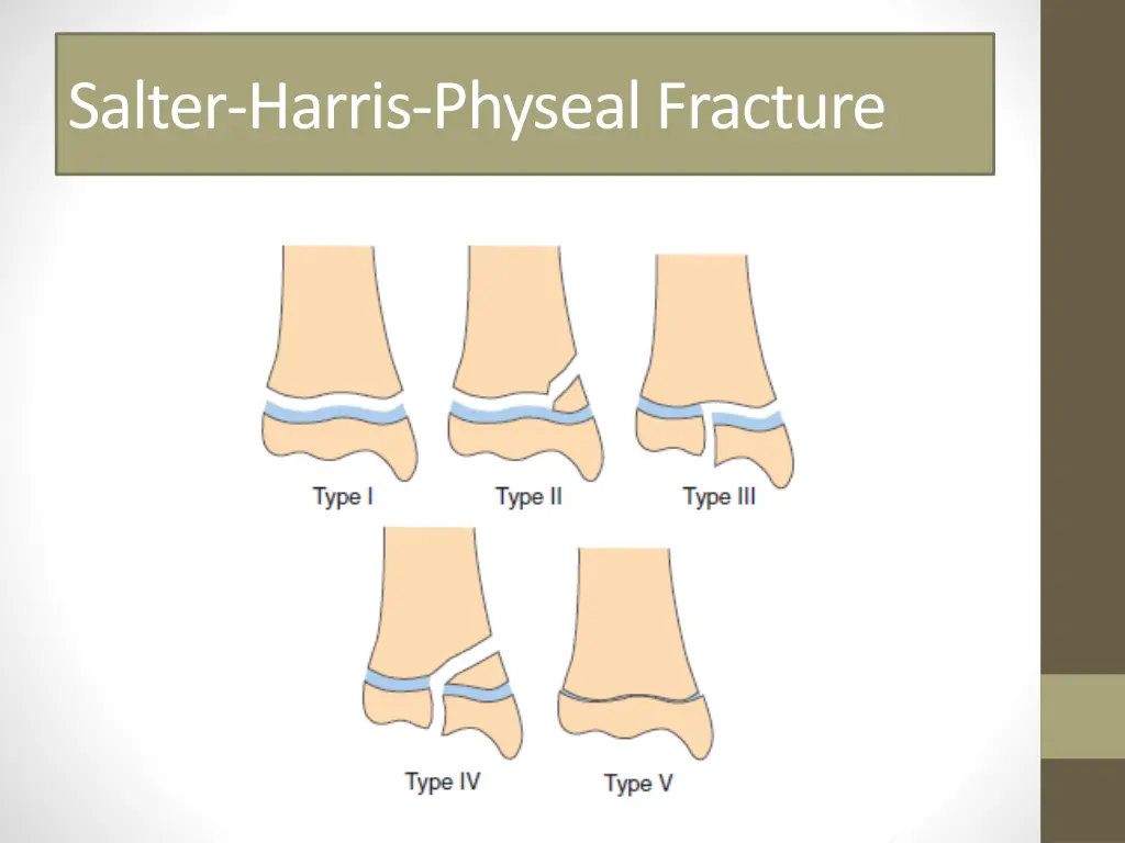 salter harris physeal fracture