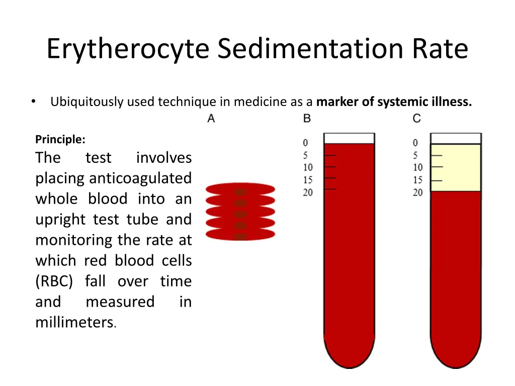 erytherocyte sedimentation rate