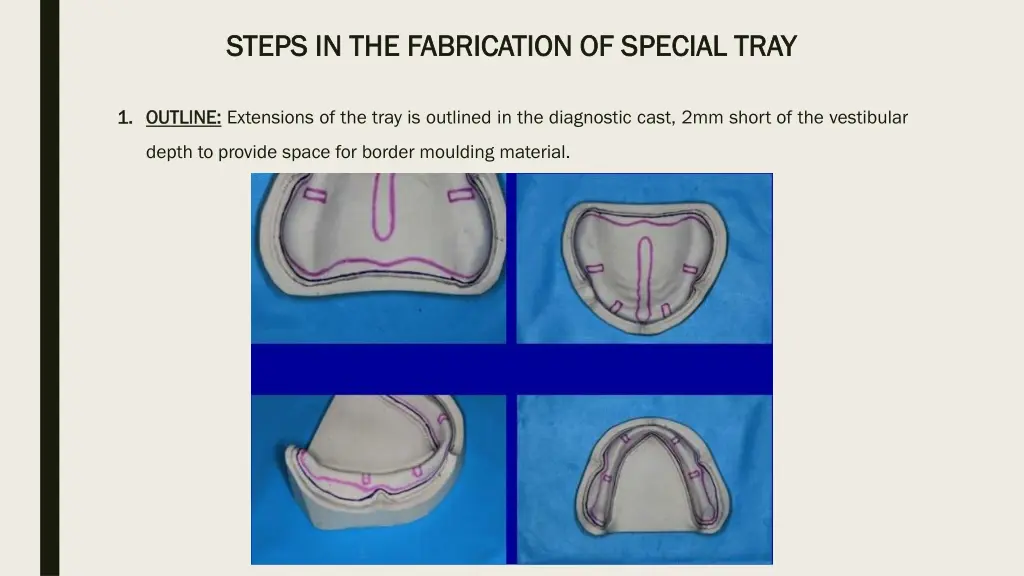 steps in the fabrication of special tray steps