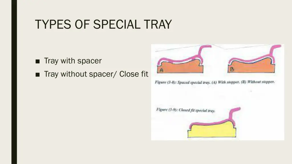 types of special tray