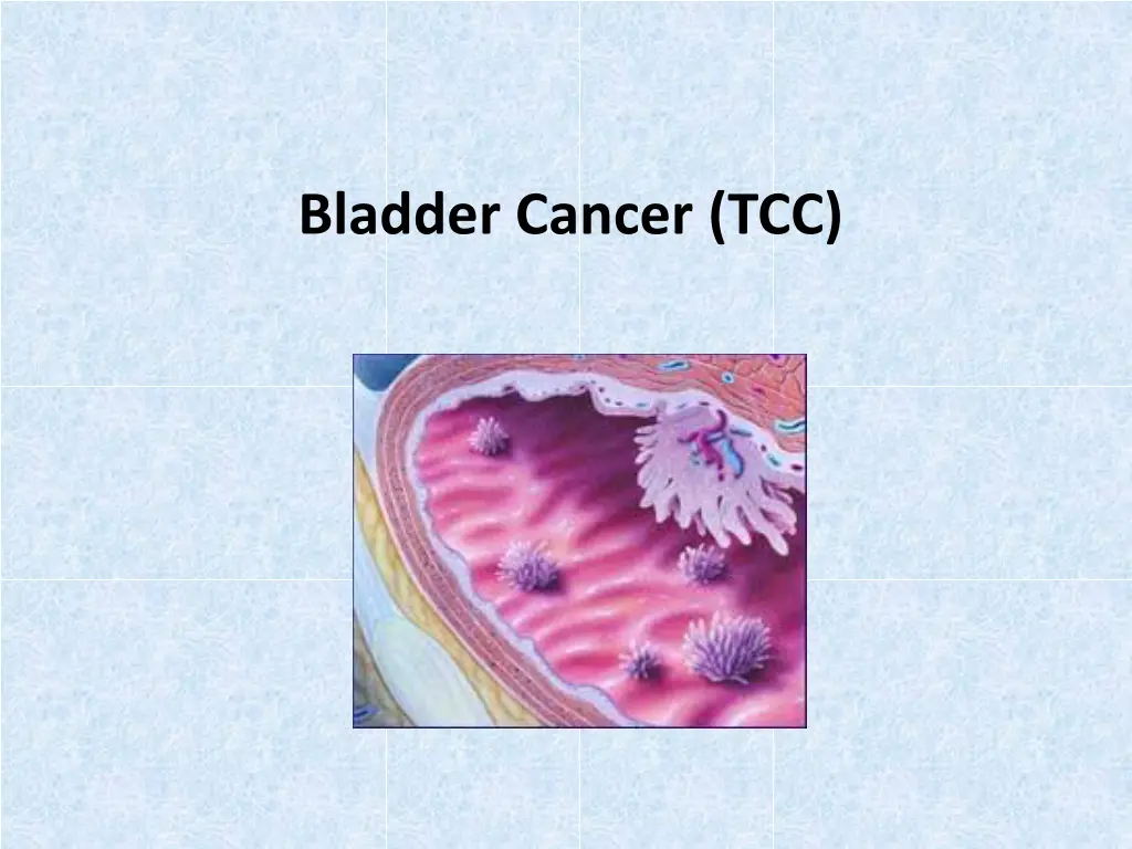 bladder cancer tcc