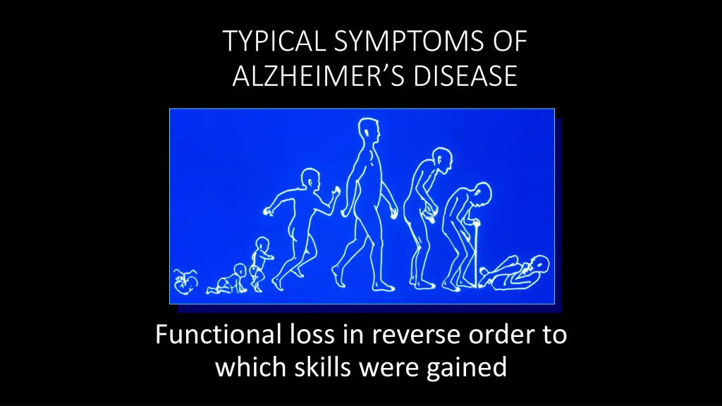 typical symptoms of alzheimer s disease