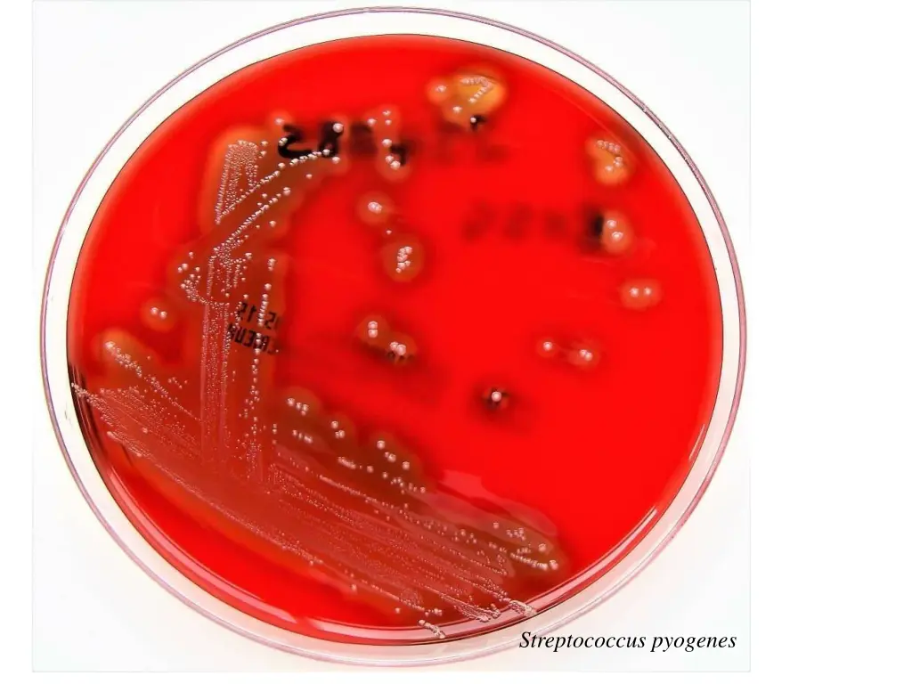 streptococcus pyogenes