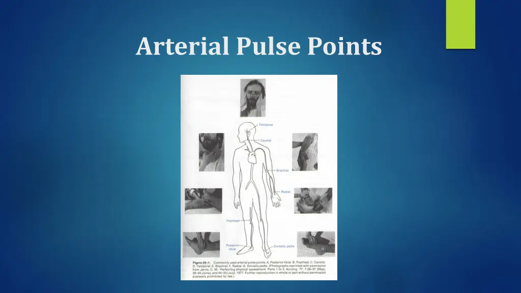 arterial pulse points