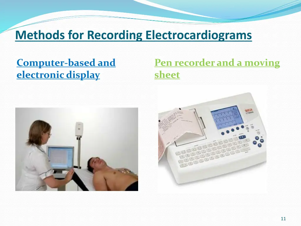 methods for recording electrocardiograms