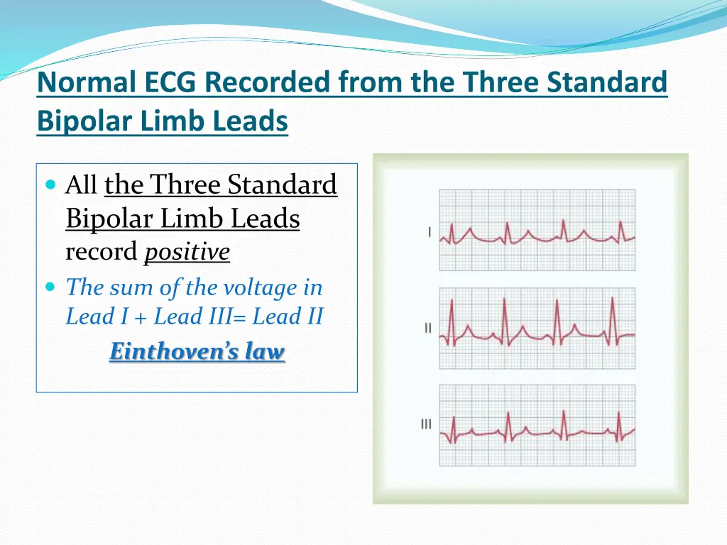 normal ecg recorded from the three standard