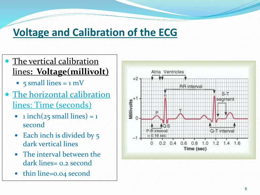 voltage and calibration of the ecg