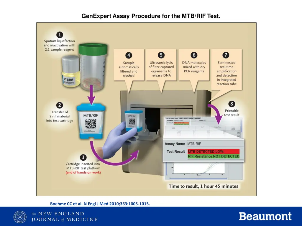 genexpert assay procedure for the mtb rif test