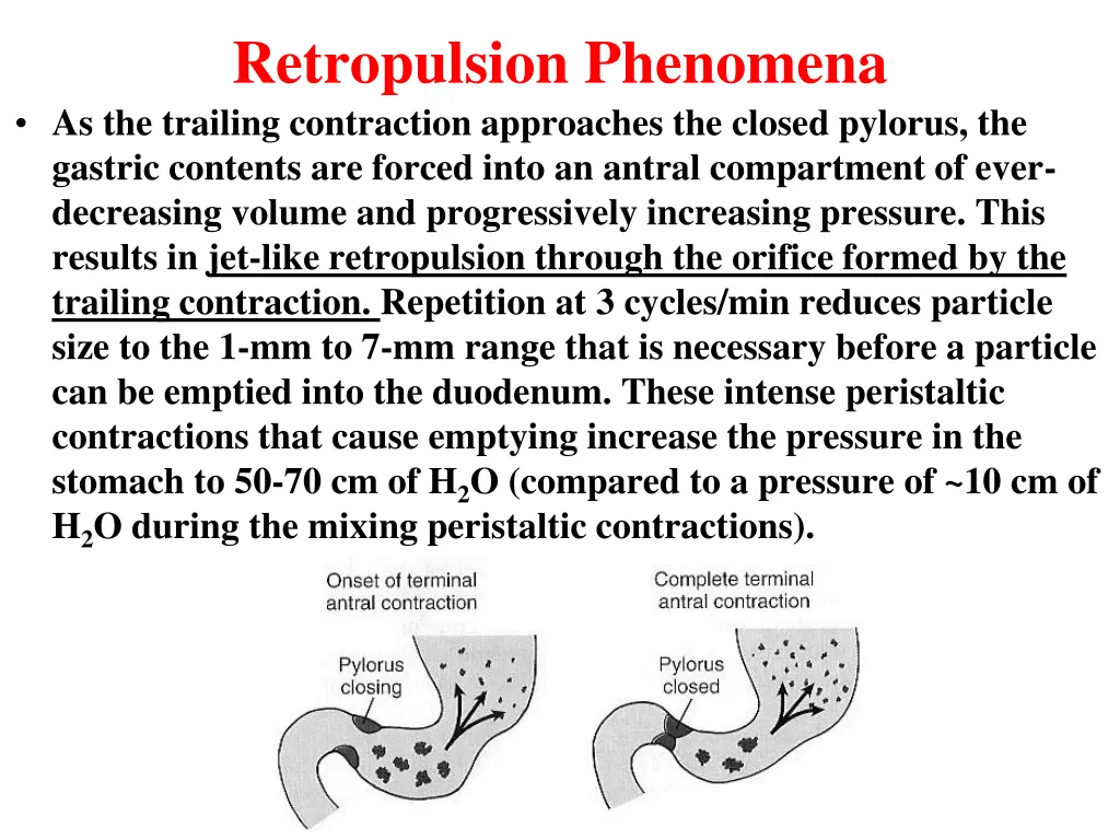 retropulsion phenomena as the trailing