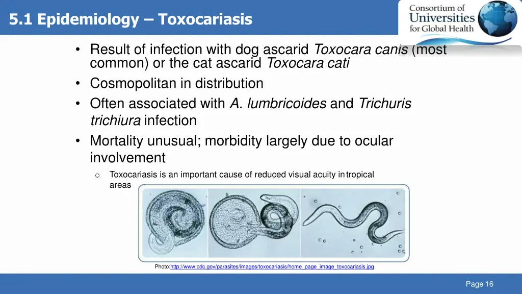 5 1 epidemiology toxocariasis