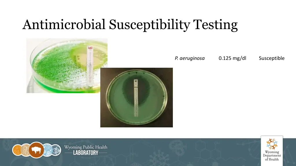 antimicrobial susceptibility testing 3