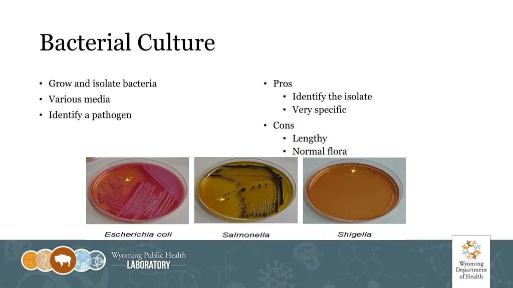 bacterial culture